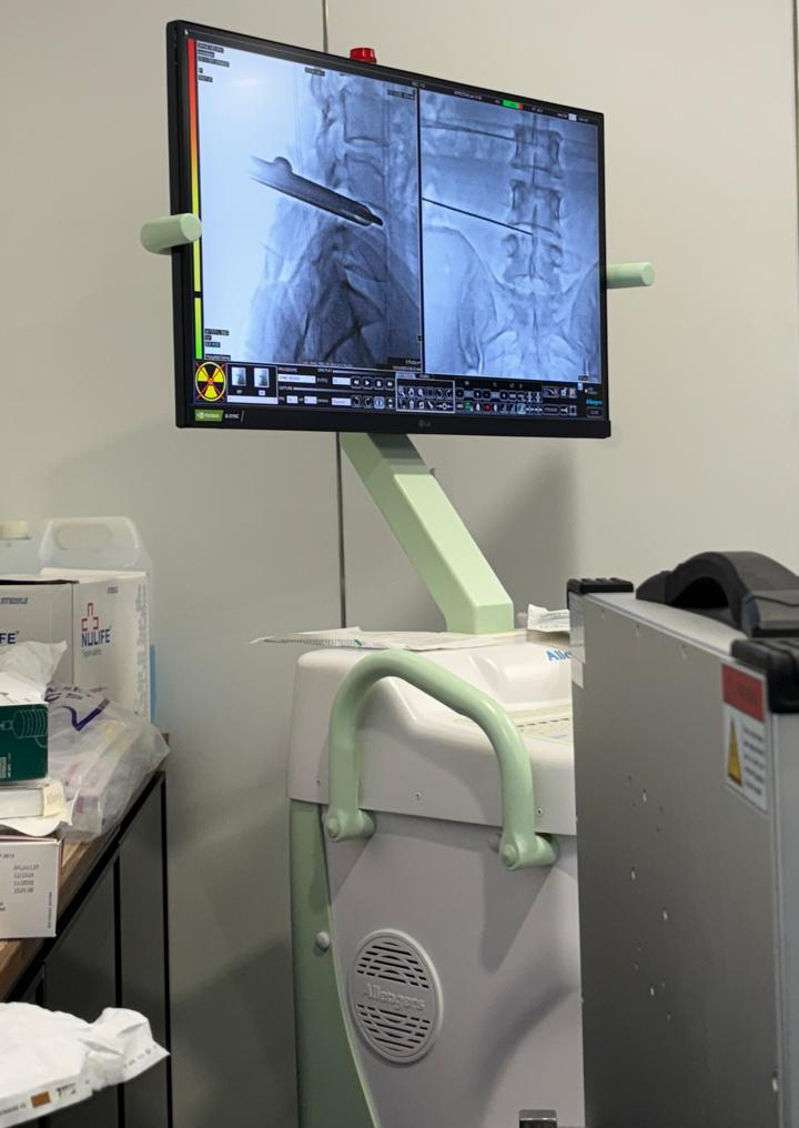 BPSC American Method OLLIF Surgery